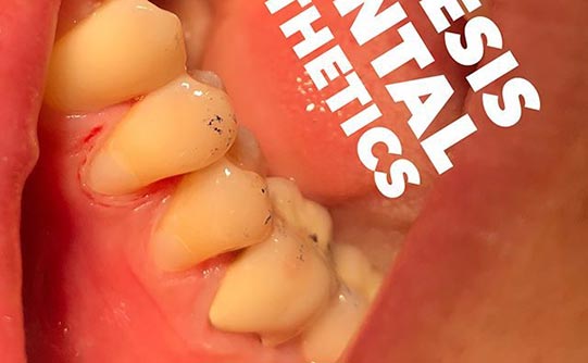 Case 7 after smile design pasadena
